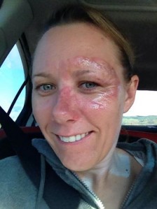 Smiling hurts at the moment for Gelsomino