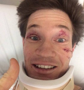 Jason Doyle recovering in hospital