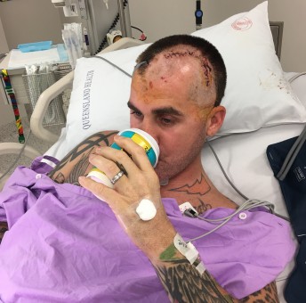 Matt Mingay recovering in ICU after surgeons operated to clear residual blood from his brain